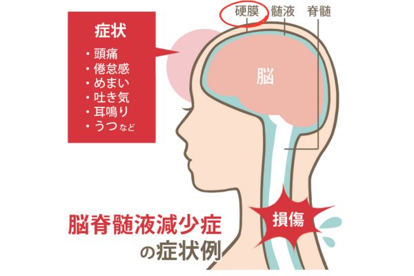 米倉涼子病気原因