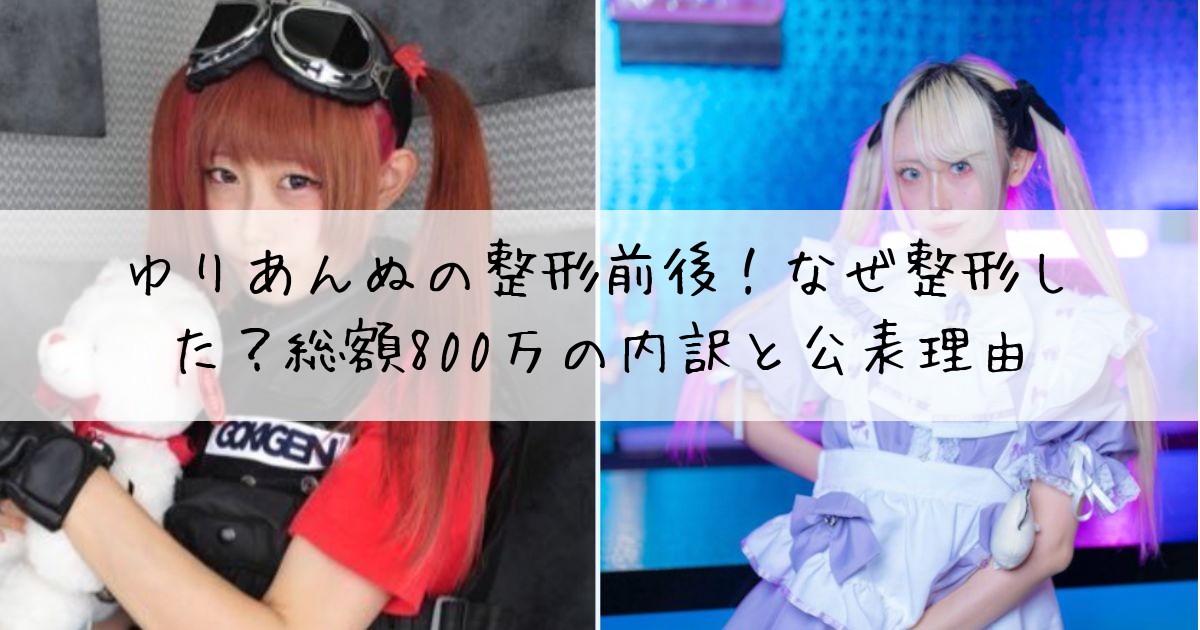 ゆりあんぬ整形